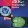 Hughes Syndrome: Antiphospholipid Syndrome, 1st Edition eBook
