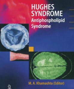 Hughes Syndrome: Antiphospholipid Syndrome, 1st Edition eBook