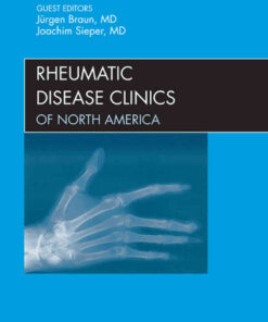 Spondyloarthropathies, An Issue of Rheumatic Disease Clinics eBook