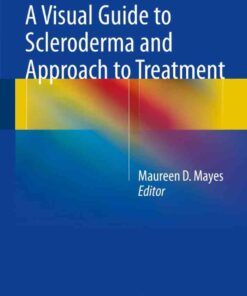 A Visual Guide to Scleroderma and Approach to Treatment eBook