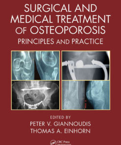 Surgical and Medical Treatment of Osteoporosis: Principles and Practice, 1st Edition eBook