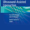 Ultrasound-Assisted Liposuction: Current Concepts and Techniques eBook