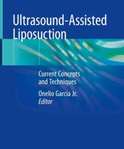 Ultrasound-Assisted Liposuction: Current Concepts and Techniques eBook