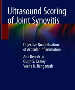 Ultrasound Scoring of Joint Synovitis: Objective Quantification of Articular Inflammation eBook