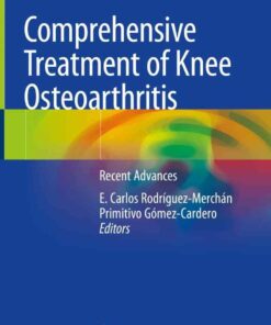 Comprehensive Treatment of Knee Osteoarthritis: Recent Advances, 1st Edition eBook