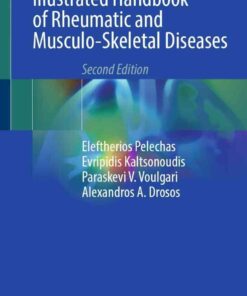 Illustrated Handbook of Rheumatic and Musculo-Skeletal Diseases, 2nd Edition eBook