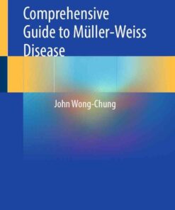 Comprehensive Guide to Müller-Weiss Disease eBook