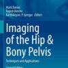 Imaging of the Hip & Bony Pelvis: Techniques and Applications, 2nd Edition eBook
