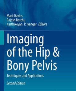 Imaging of the Hip & Bony Pelvis: Techniques and Applications, 2nd Edition eBook