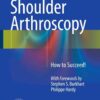 Shoulder Arthroscopy: How to Succeed! eBook