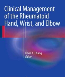 Clinical Management of the Rheumatoid Hand, Wrist, and Elbow eBook