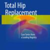 Total Hip Replacement: Case Series from a Leading Registry eBook