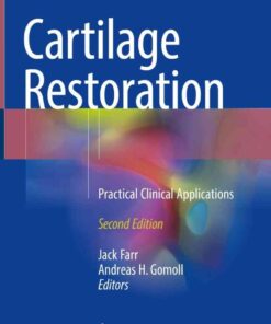 Cartilage Restoration: Practical Clinical Applications, 2nd Edition eBook