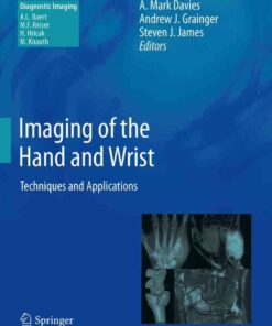 Imaging of the Hand and Wrist: Techniques and Applications eBook