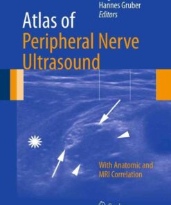 Atlas of Peripheral Nerve Ultrasound: With Anatomic and MRI Correlation eBook