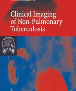 Clinical Imaging in Non-Pulmonary Tuberculosis eBook