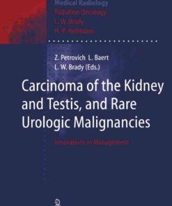 Carcinoma of the Kidney and Testis, and Rare Urologic Malignancies: Innovations in Management eBook