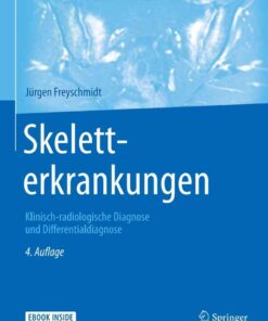 Skeletterkrankungen: Klinisch-radiologische Diagnose und Differentialdiagnose, 4th Edition eBook