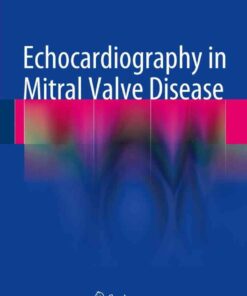 Echocardiography in Mitral Valve Disease eBook