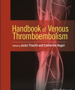 Handbook of Venous Thromboembolism eBook
