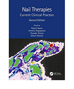 Nail Therapies: Current Clinical Practice eBook