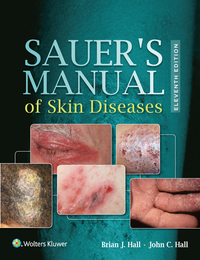 Sauer's Manual of Skin Diseases eBook