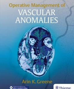 Operative Management of Vascular Anomalies eBook