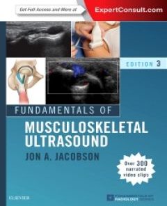 Fundamentals of Musculoskeletal Ultrasound eBook