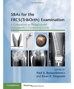 SBAs for the FRCS(Tr&Orth) Examination: A Companion to Postgraduate Orthopaedics Candidate's Guide eBook