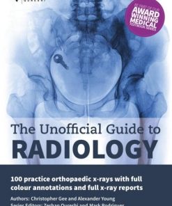 The Unofficial Guide to Radiology: 100 Practice Orthopaedic X-Rays with Full Colour Annotations and Full X-Ray Reports eBook