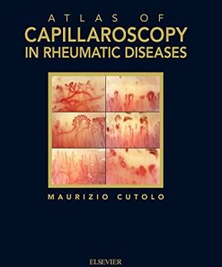 Atlas of capillaroscopy in rheumatic diseases eBook