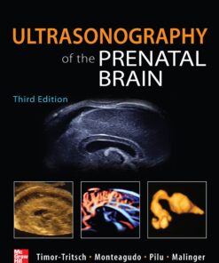 Ultrasonography of the Prenatal Brain, Third Edition eBook