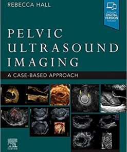 Pelvic Ultrasound Imaging, E-Book: A Cased-Based Application eBook