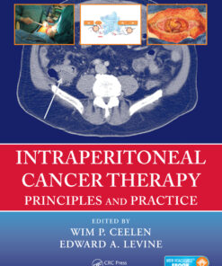 Intraperitoneal Cancer Therapy: Principles and Practice eBook