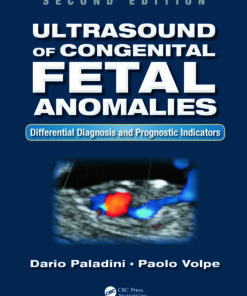 Ultrasound of Congenital Fetal Anomalies: Differential Diagnosis and Prognostic Indicators, Second Edition eBook