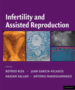 Infertility and Assisted Reproduction eBook