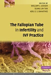 The Fallopian Tube in Infertility and IVF Practice eBook