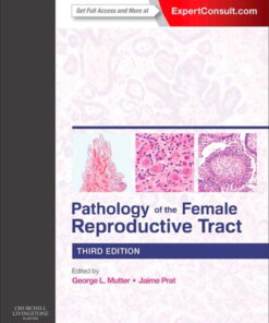 Pathology of the Female Reproductive Tract E-Book eBook