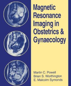 Magnetic Resonance Imaging in Obstetrics and Gynaecology eBook