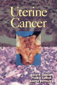 Uterine Cancer eBook