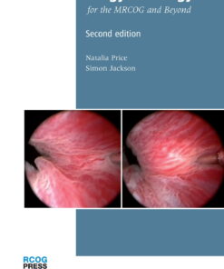 Urogynaecology for the MRCOG and Beyond eBook