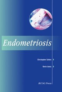 Endometriosis eBook