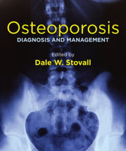 Osteoporosis: Diagnosis and Management eBook