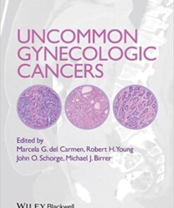 Uncommon Gynecologic Cancers eBook