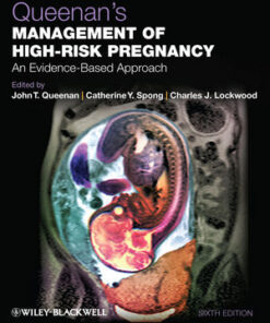 Queenan's Management of High-Risk Pregnancy: An Evidence-Based Approach eBook