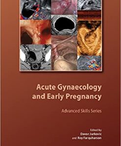 Acute Gynaecology and Early Pregnancy eBook
