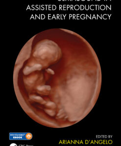 Ultrasound in Assisted Reproduction and Early Pregnancy eBook
