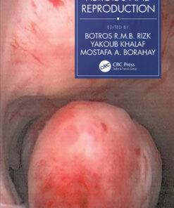 Fibroids and Reproduction eBook