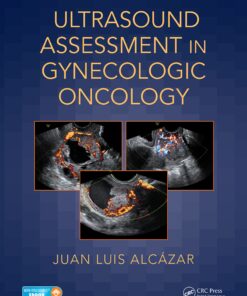 Ultrasound Assessment in Gynecologic Oncology eBook