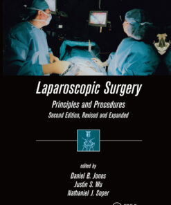 Laparoscopic Surgery: Principles and Procedures, Second Edition, Revised and Expanded eBook